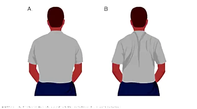 Kürek Kemiği Sıkıştırma (Shoulder Blade Squeeze)